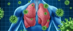 Allergic diseases of the respiratory system