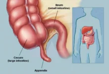 Appendix