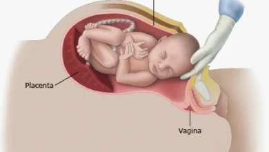 Normal Birth and Cesarean Section
